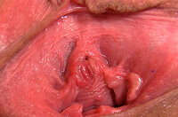 Gape My Pussy Forum s1